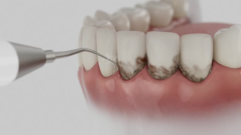 Reliable Root Canal Treatment contractor in Muhlenberg County County, KY by Dentist Open Now